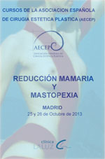 Reducción mamaria y mastopexia